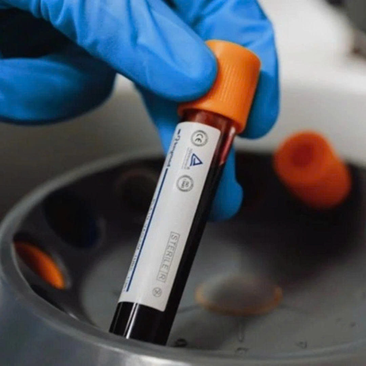 Home Blood Tests for Cancer Screening: Expert Caution Advised