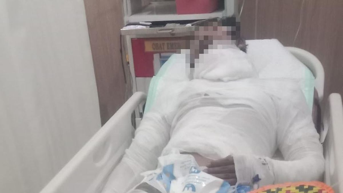 Bali Truck Driver Set on Fire by Boss Dies After Week-Long Battle for Life