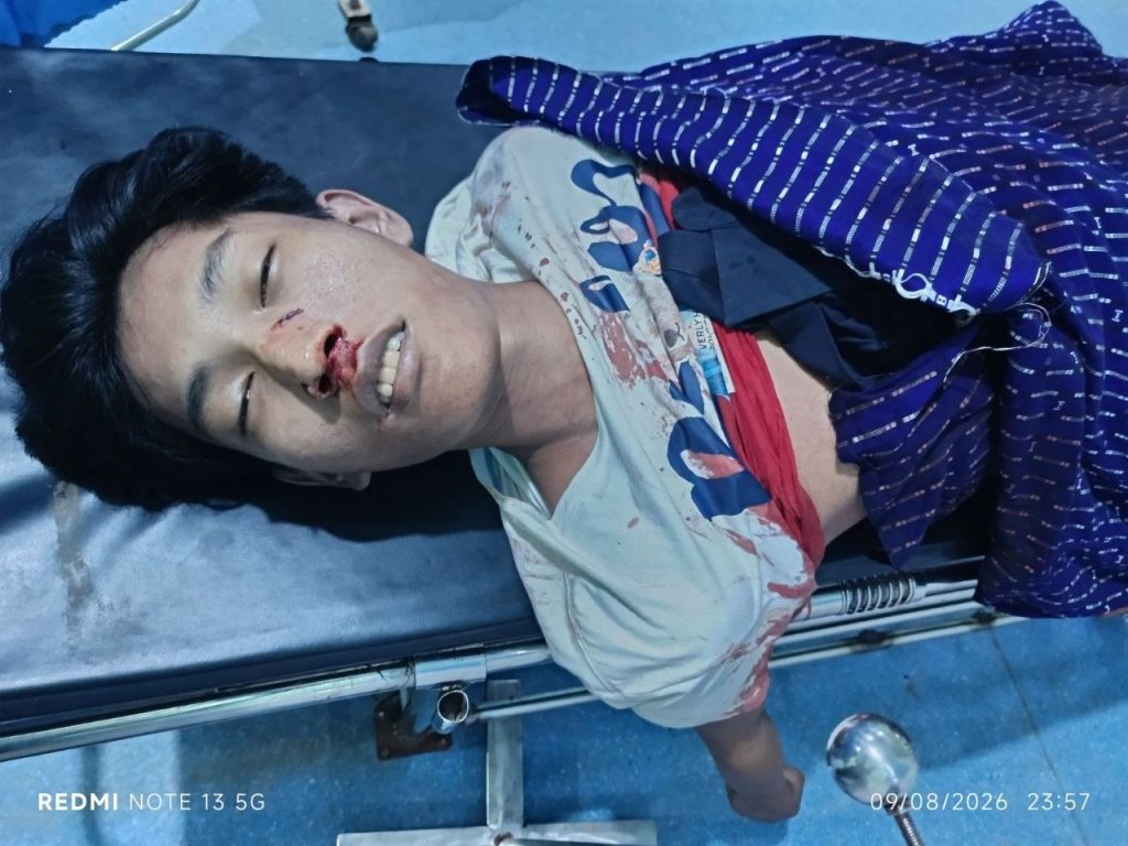 One dies in stabbing incident between university students in Pyin Oo Lwin
