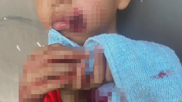 タイで子供たちの手製爆弾が爆発、4人負傷