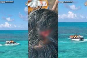 Chinese Coast Guard Hit Philippine Navy Sailor in South China Sea Encounter, Military Says