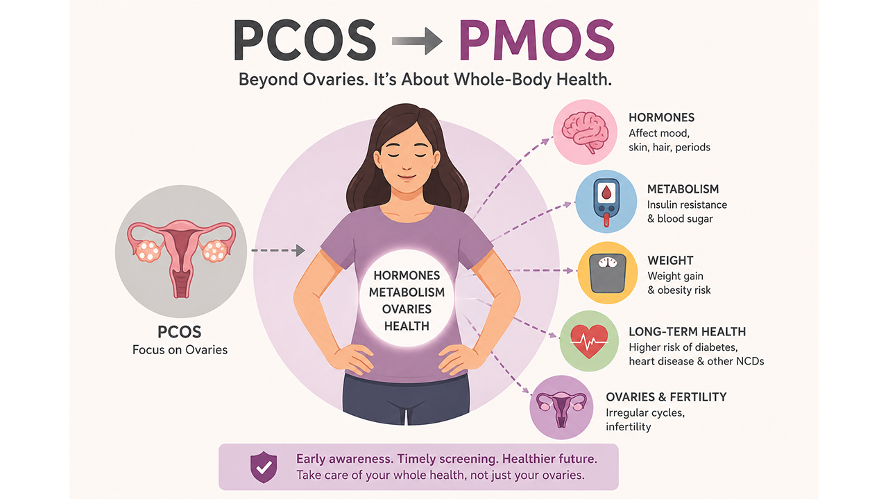 PCOS Renamed PMOS to Highlight Diabetes and Metabolic Risks in Women