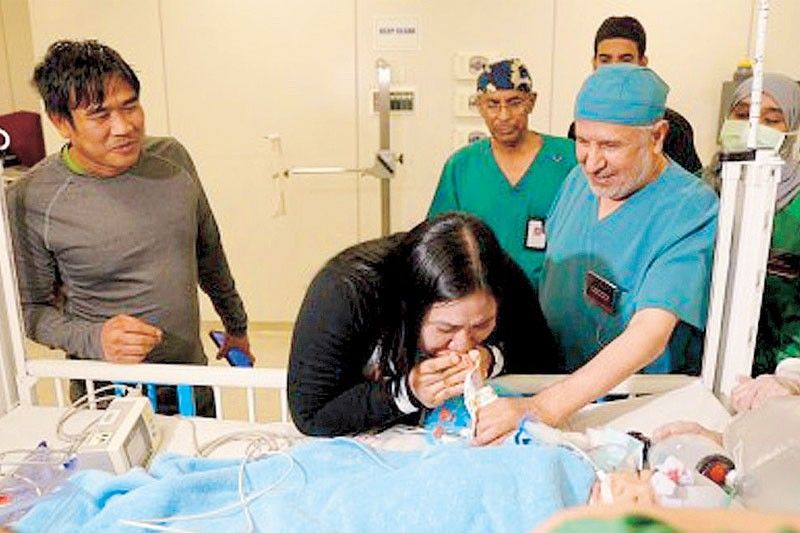 Filipino Conjoined Twins Successfully Separated in Saudi Arabia