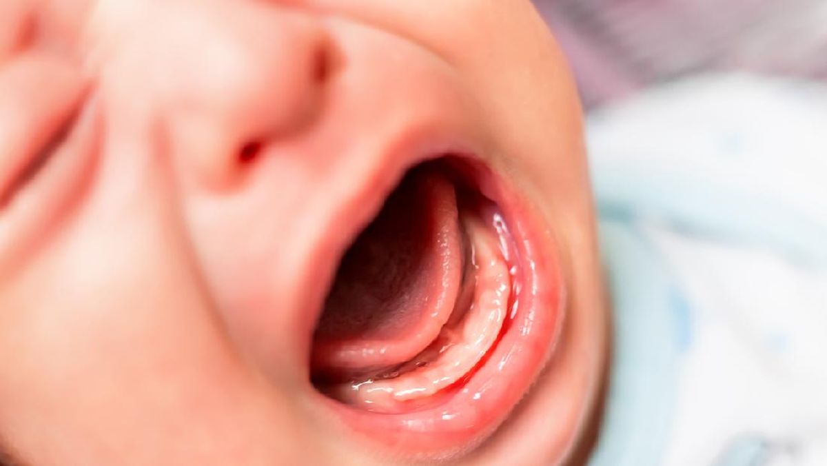 Yogyakarta Daycare Abuse Scandal: Children Show Signs of Malnutrition and Developmental Delays