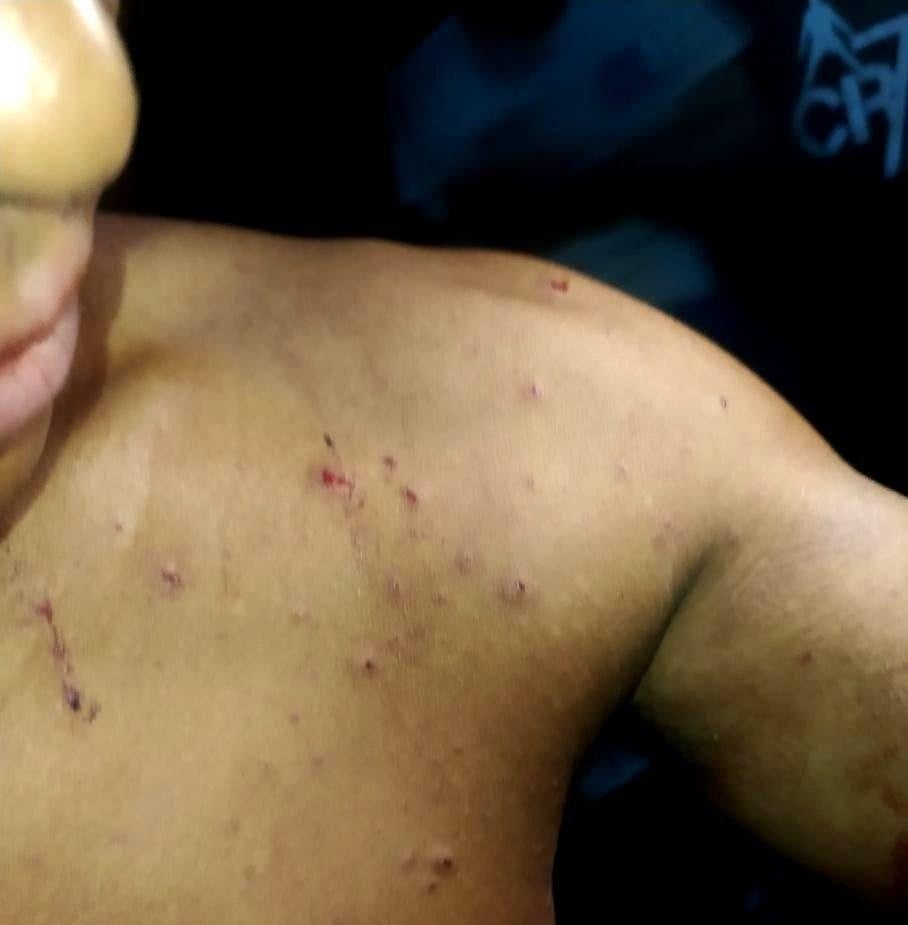 Myanmar naval artillery strike in Kyaukphyu leaves elderly woman dead and seven others injured, including a monk