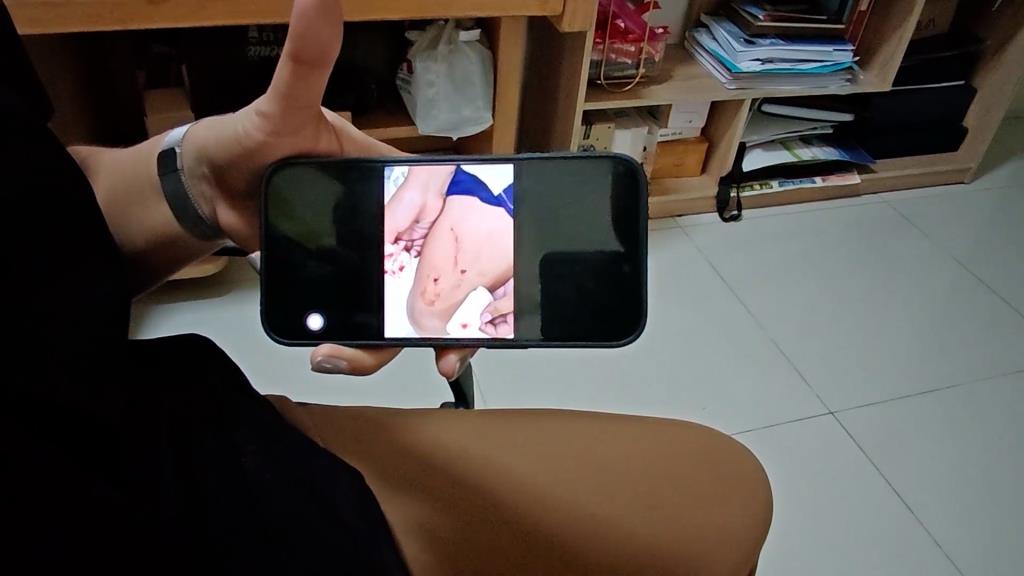 Lampang, Thailand: 10-Year-Old Stabs Classmate 16 Stitches After Being Named by Teacher