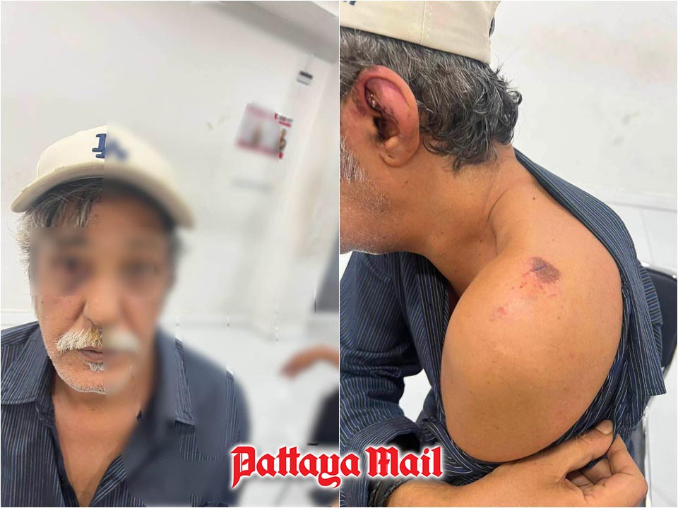 Kuwaiti Tourist Robbed, Injured After Pattaya Bar Encounter