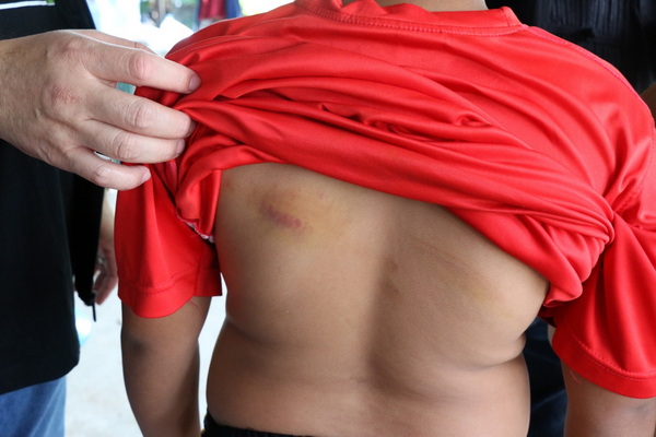 Teacher's Corporal Punishment of 5th Grader Sparks Outrage in Thailand