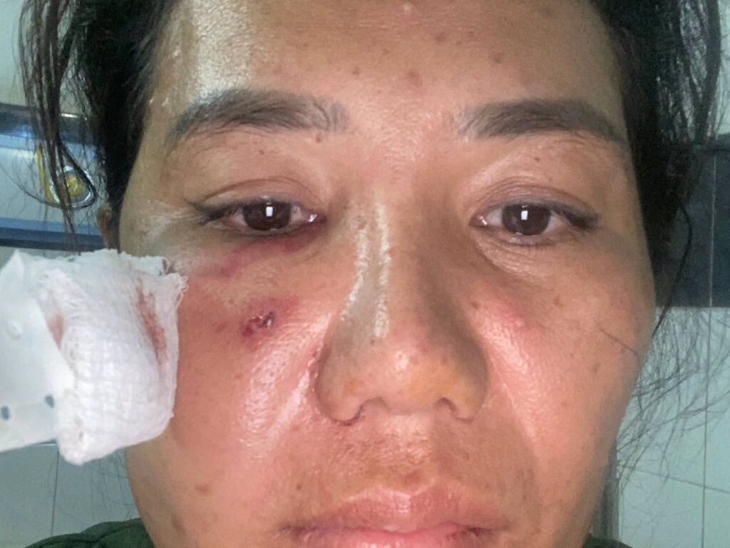 カンポットチャナン州で土地境界争いから発展、女性に重傷を負わせた男を逮捕
