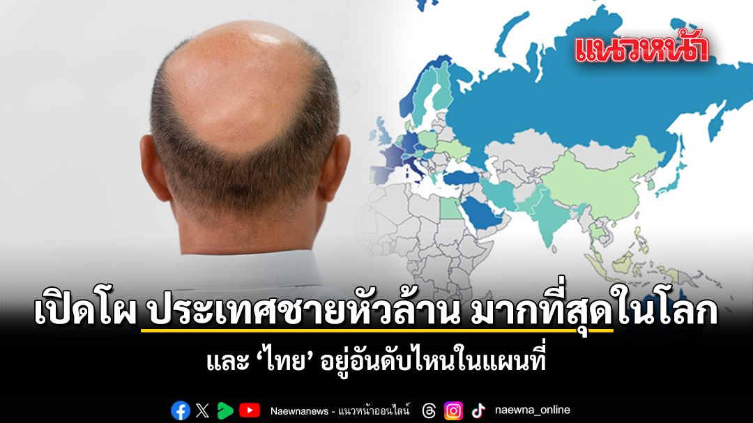 Global Male Baldness Rankings: Where Does Thailand Stand?