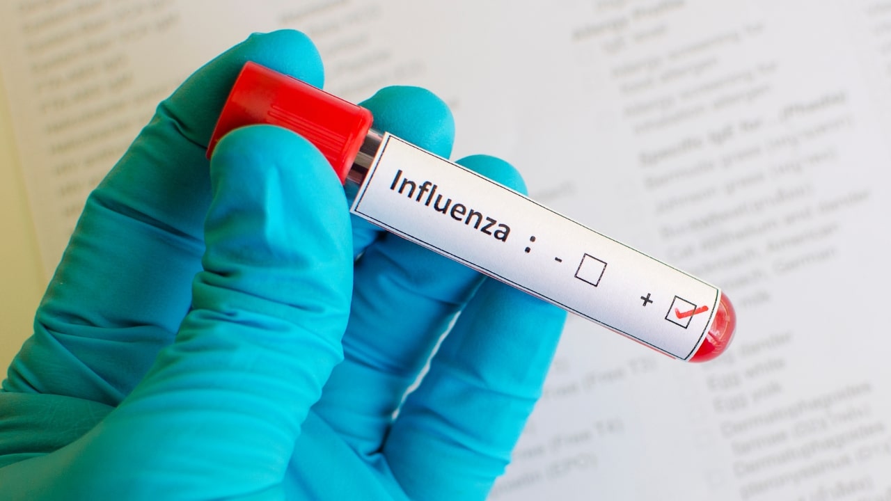 18 New Flu-Like Illness Cases Reported in Manila; Total Reaches 1,955