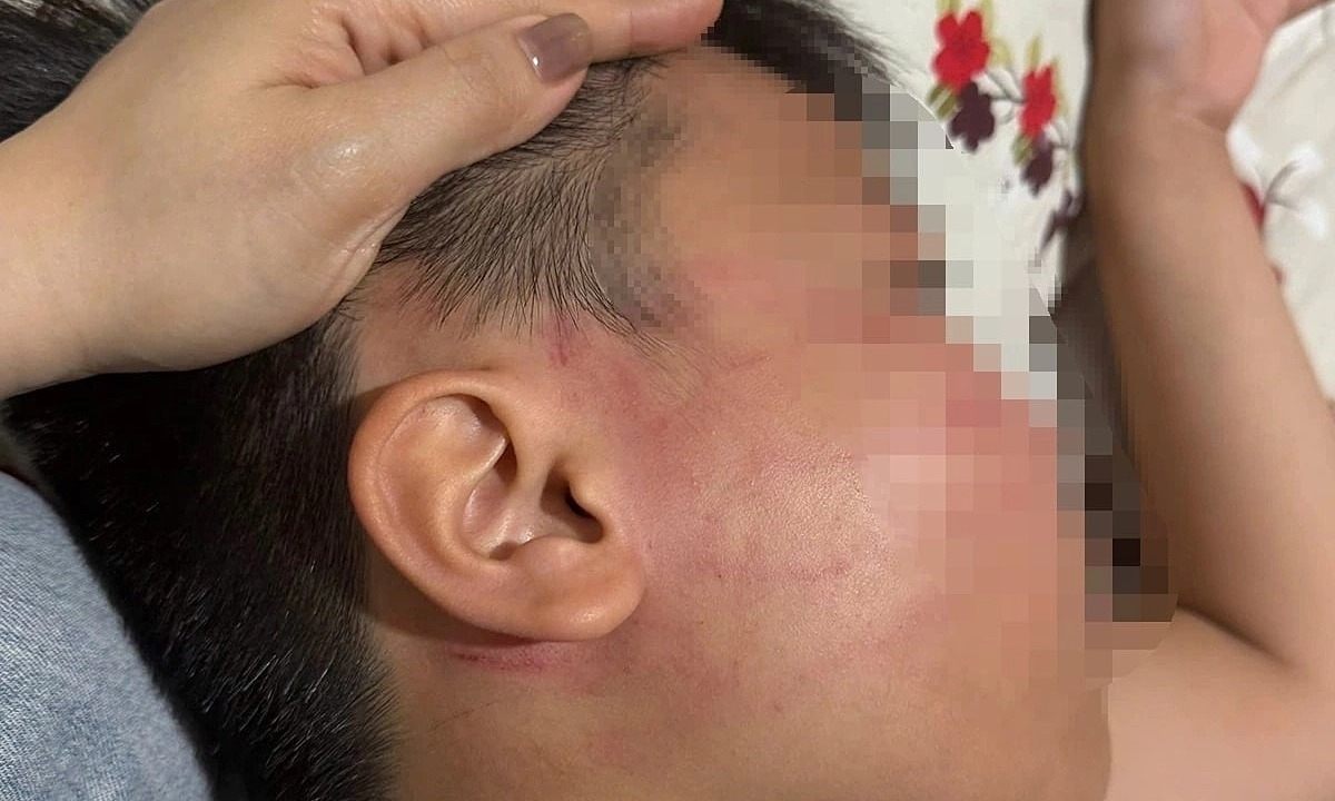 ベトナム、外国人講師による児童への体罰疑惑で捜査
