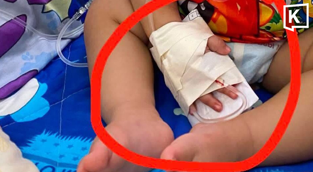 Baby Loses Finger in Alleged Hospital Scissors Mishap During IV Tape Removal